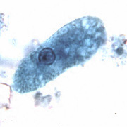 E. coli trofozoíta