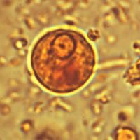 E. histolytica (cisto)