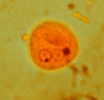 E. histilytica (cisto)
