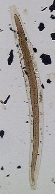 larvas_filarioides_ancilostomideo.jpg